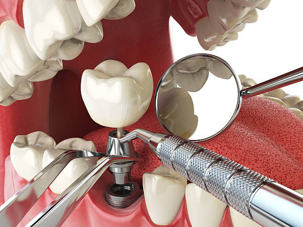 Best Emergency Cosmetic Dentistry in Point Mackenzie, AK